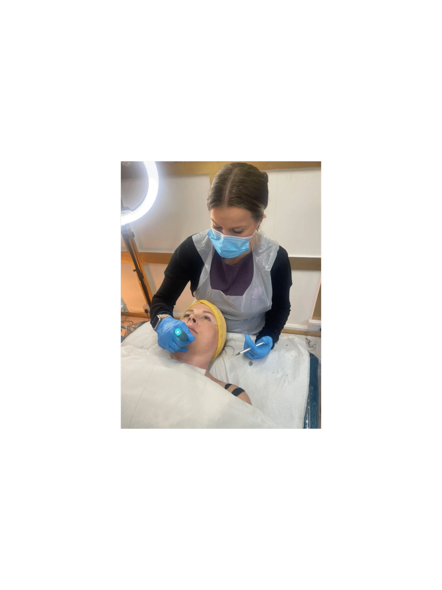 Microneedling
